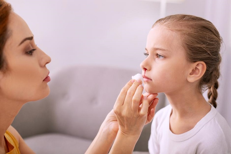 Krvarenje nosa kod djece: Znaš li kako ga pravilno zaustaviti?