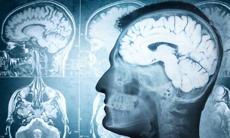 Znanstvenici otkrili misteriozan skok moždane aktivnosti kod pacijenata u trenutku njihove smrti
