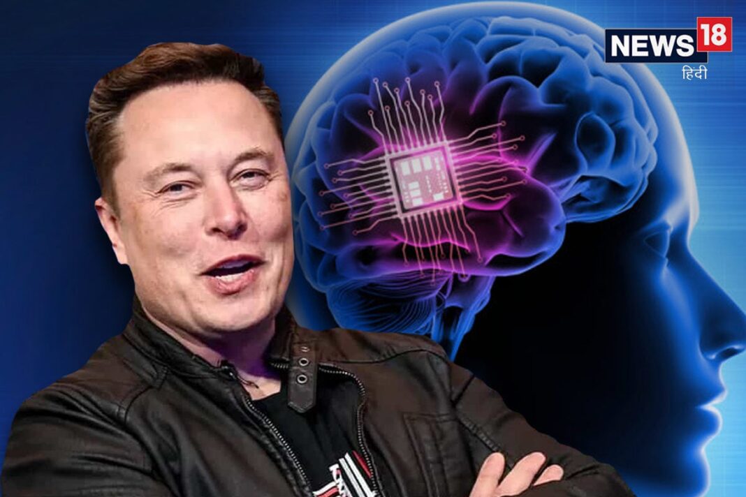 Musk dobio dozvolu da ugrađuje čipove u ljudski mozak