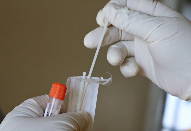 Australska tvrtka povukla u SAD-u 200.000 testova na koronavirus