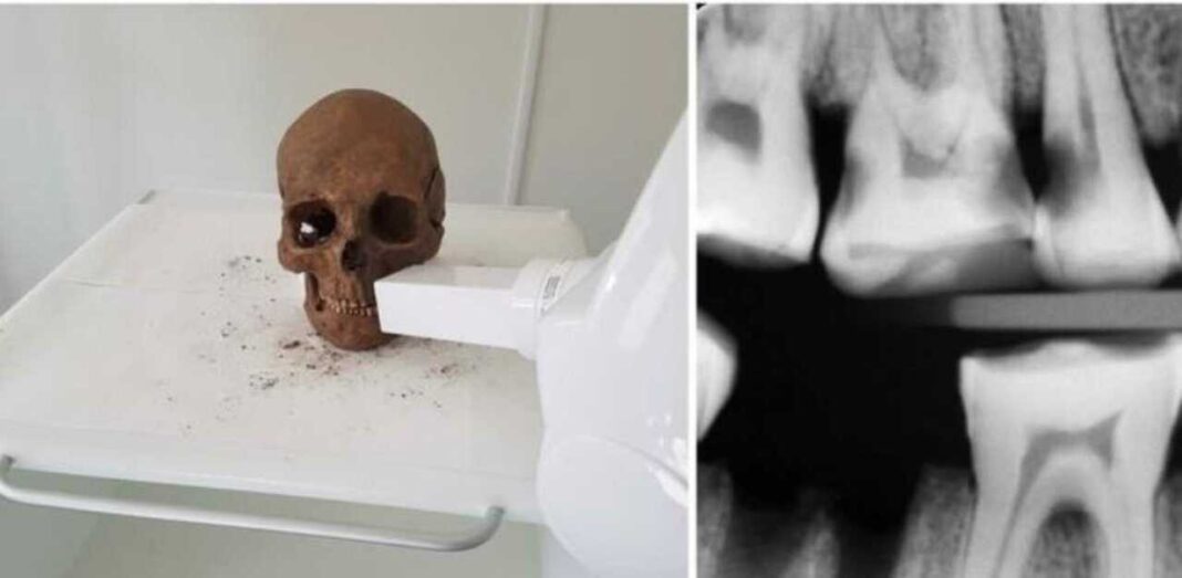 Znanstvenici pronašli zube stare tisuću godina